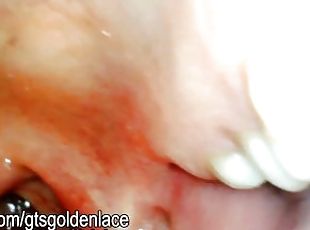 Gummy vore with endo cam